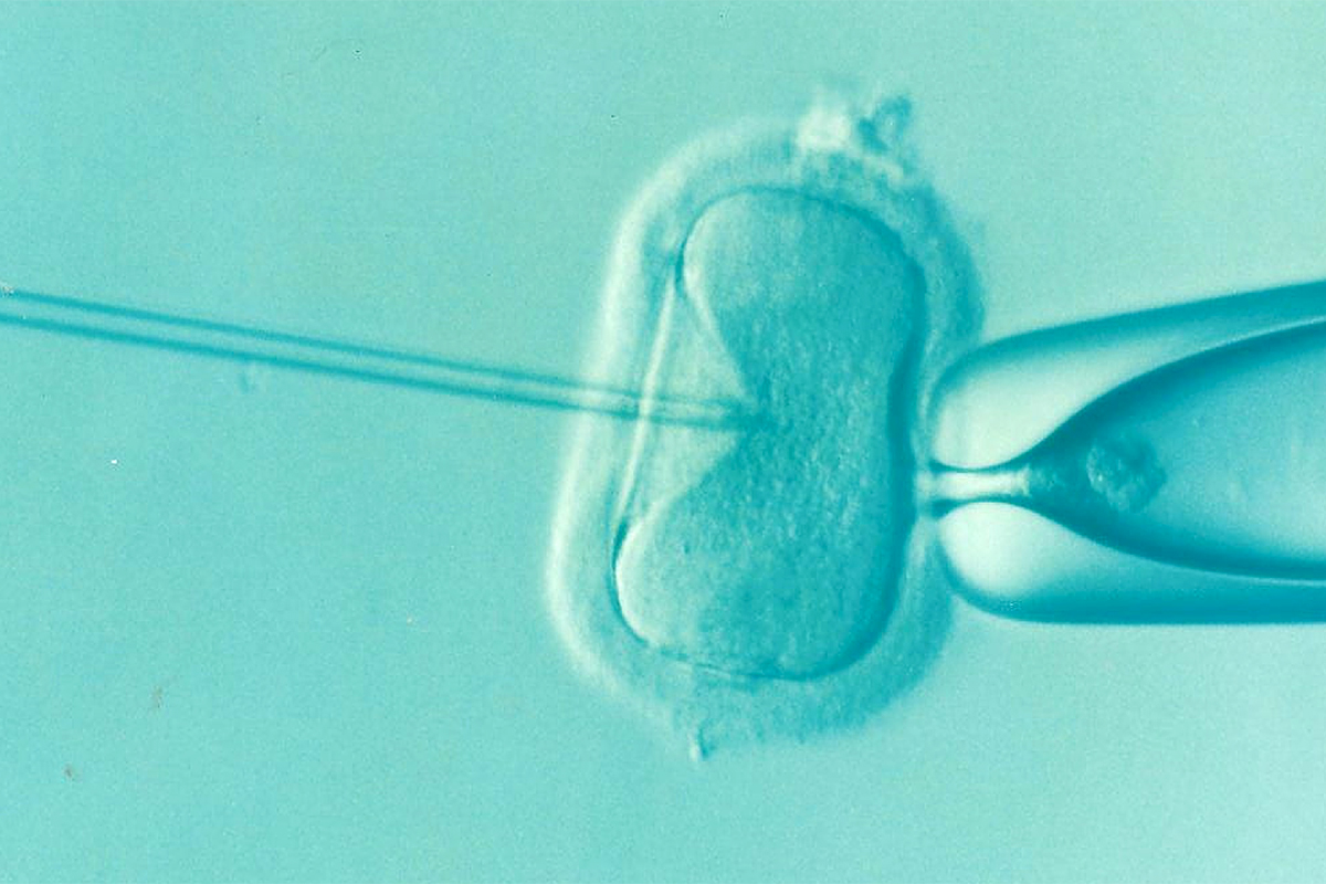 IVF