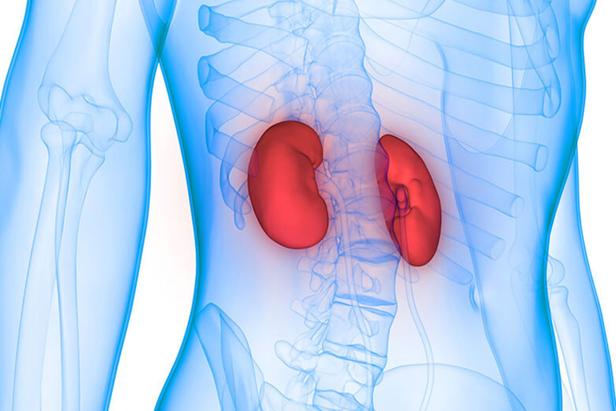 CKD2 031022